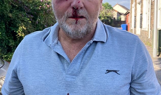 Christopher Lavis, 69, was punched in the face in the violent attack, which left him with a black eye, bleeding nose and blood-stained polo shirt