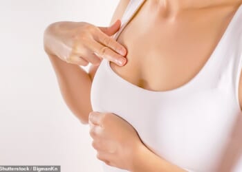 Breast cancer survivors face hidden costs of up to £12,000 a year despite the NHS being free at the point of care, a damning report has revealed