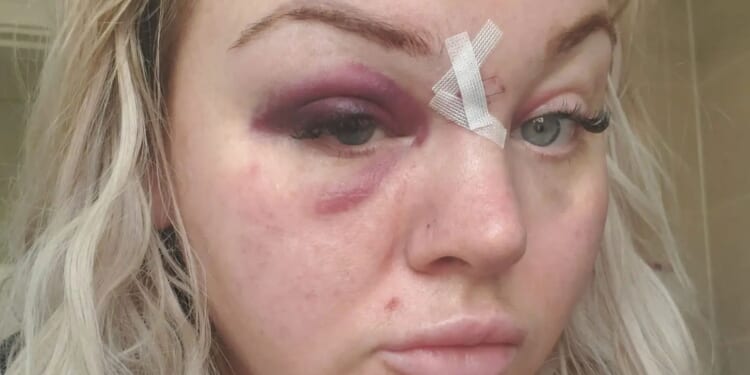 Scots mum reveals horror injuries after evil brute left her for dead in front of young son