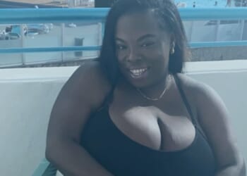 I had 40L-cups but was rejected for NHS boob reduction 4 times