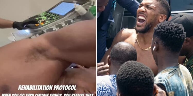 Anthony Joshua undergoes treatment on ribs as boxing legend continues rehab months after horror car crash