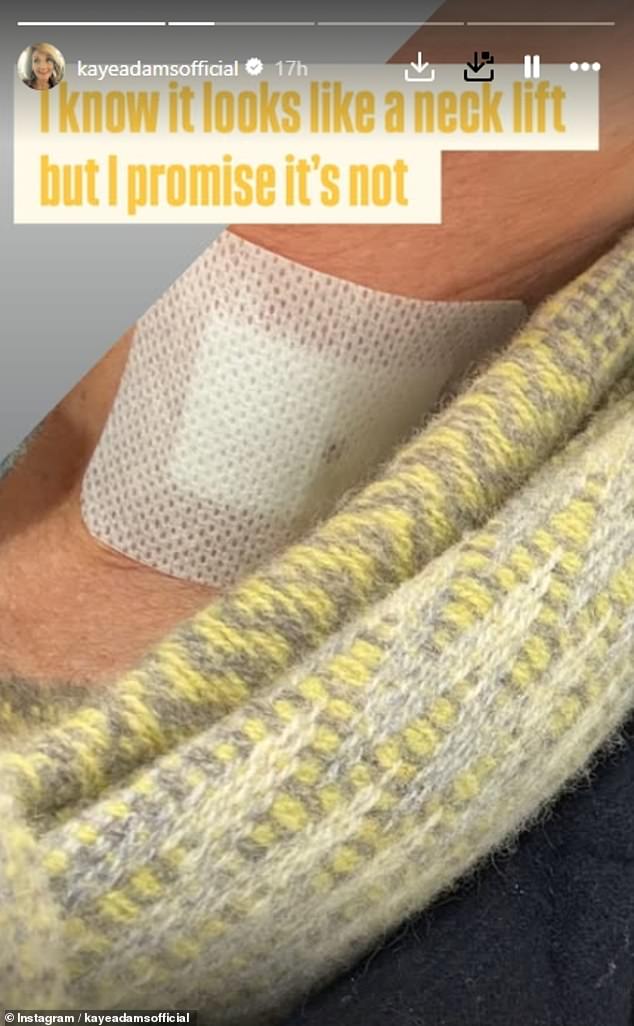 The broadcaster had sparked concern from her followers earlier this week when she shared a snap of her neck wrapped in a bandage