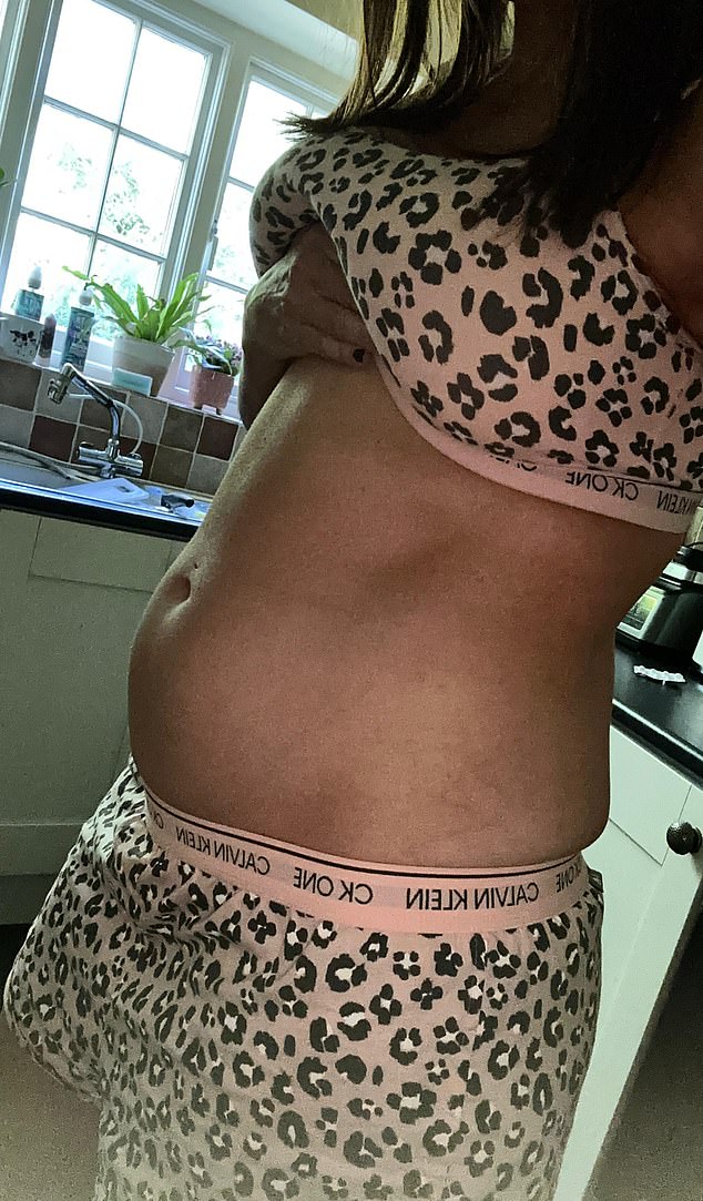 Hannah says she remembers thinking: ‘Is this just what happens? Am I going to have to accept this is how I look and feel?'