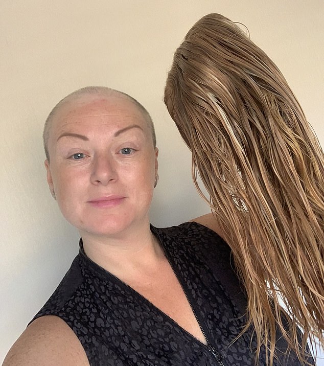 With a hair system, I felt normal for the first time. I could wear it down and blend in with no fear of judgment. Mentally, it gave me a break, while my real hair grew beneath the system