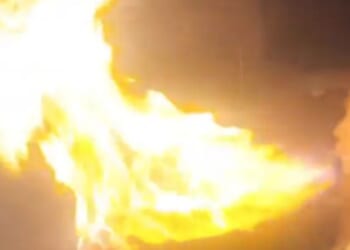 Shocking moment actress suffers horror face burns performing viral birthday cake candle trick in stupid stunt gone wrong