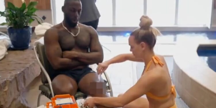 MAFS Australia groom suffers terrible fall on honeymoon and is left with huge bloody gash on leg