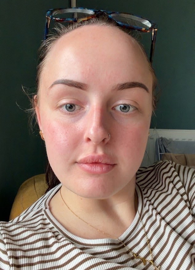 On Day 365, Bethany's appearance reflects how she feels inside: healthy and glowing