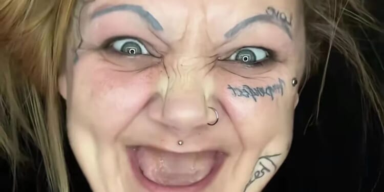 I wear dentures but trolls call me a ‘false advertisement’ & say I’m the reason men have trust issues