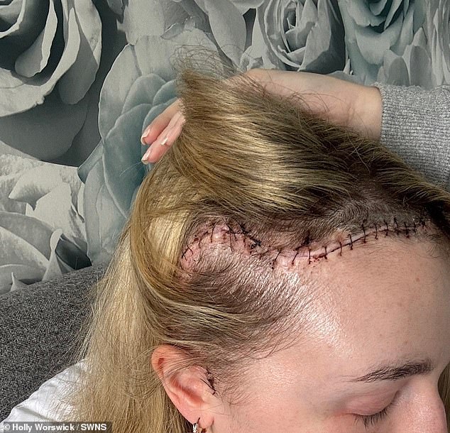 After the optician found the tumour, Ms Worswick required five brain surgeries and an additional ear operation