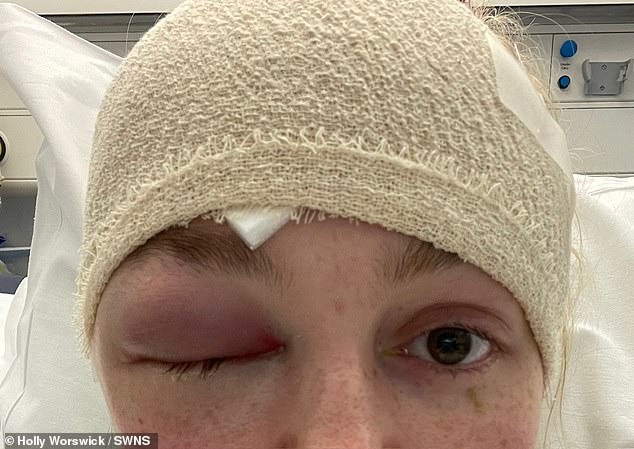 In July 2021, she had a titanium plate fitted in the space where her skull was missing, which was later replaced with one made from biocompatible material