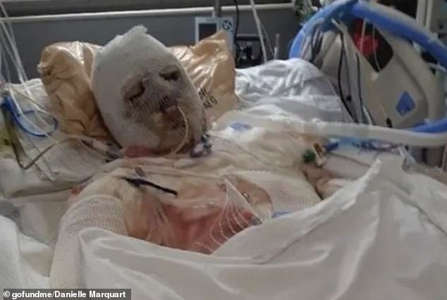 DiMeo is pictured above in the hospital after his accident