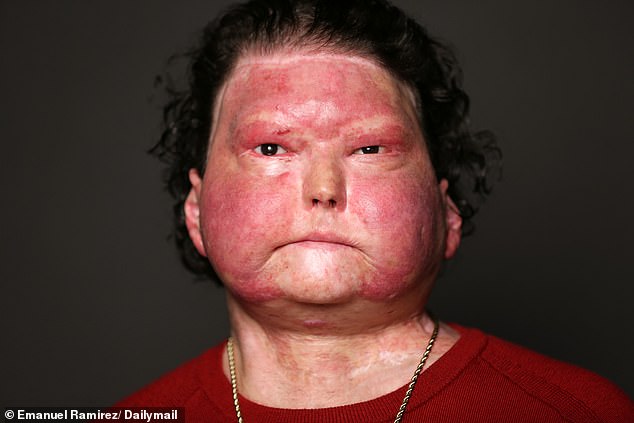 DiMeo is urging more Americans to consider donating their organs, especially as 100,000 people wait on transplant lists