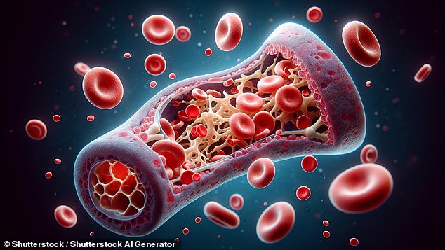 Bone marrow is the spongy tissue and fluid found in the centre of some bones, which makes different types of blood cells: red blood cells, white blood cells and platelets