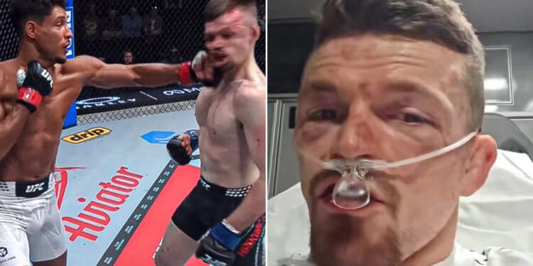'My jaw is f*' - UFC star can hardly talk as he posts health update in back of ambulance after brutal war