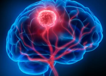 Simple blood test that detects brain tumours with over 90% accuracy created in major cancer breakthrough