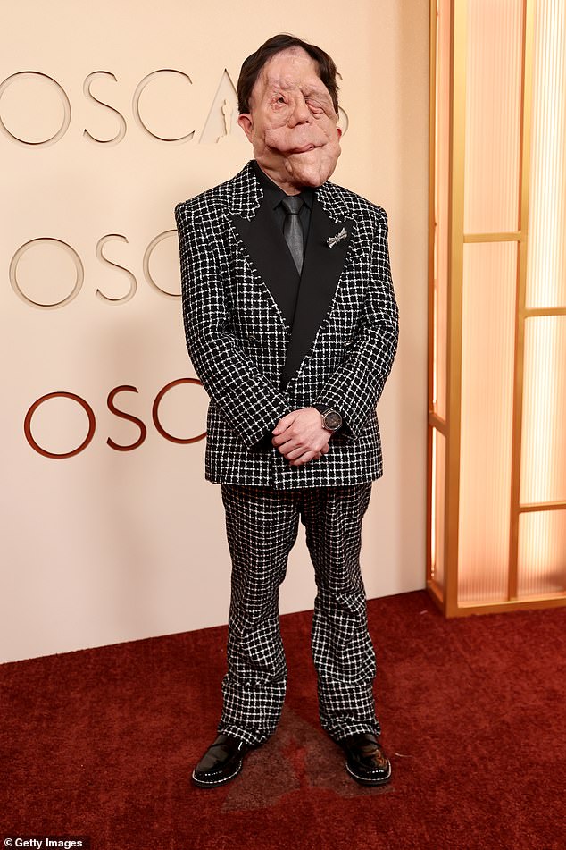 Actor and campaigner Adam Pearson opted for a sharp brown checked suit on the red carpet