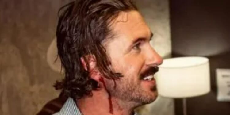 Watch moment huge country star kicks 'jealous boyfriend' out of his show after he's hit with a phone and left BLEEDING