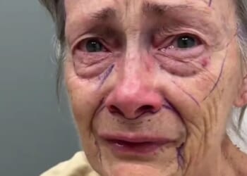 See how a 70-year-old woman goes from ‘looking 90’ to ‘40’ in a matter of weeks leaving people utterly speechless