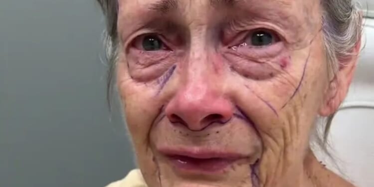 See how a 70-year-old woman goes from ‘looking 90’ to ‘40’ in a matter of weeks leaving people utterly speechless