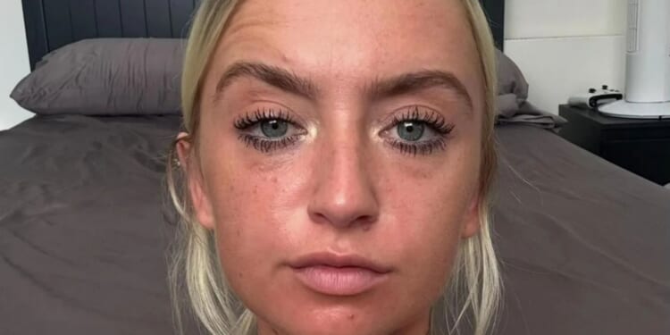 I was addicted to sunbeds at 24