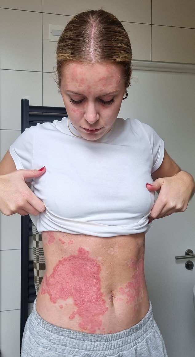 Some days it doesn’t bother me too much, sometimes I still want to hide