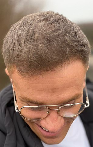 Rob now, after his treatment