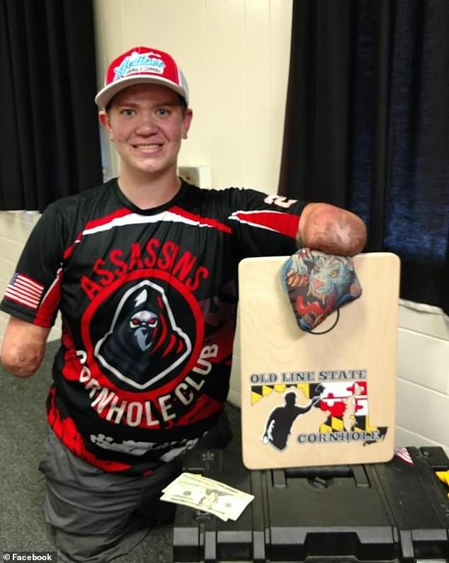 Dayton Webber, 27, is able to compete in cornhole by holding the bag between his arms