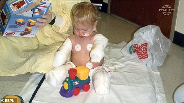 Webber was diagnosed with a bacterial infection as a child that ultimately led to sepsis