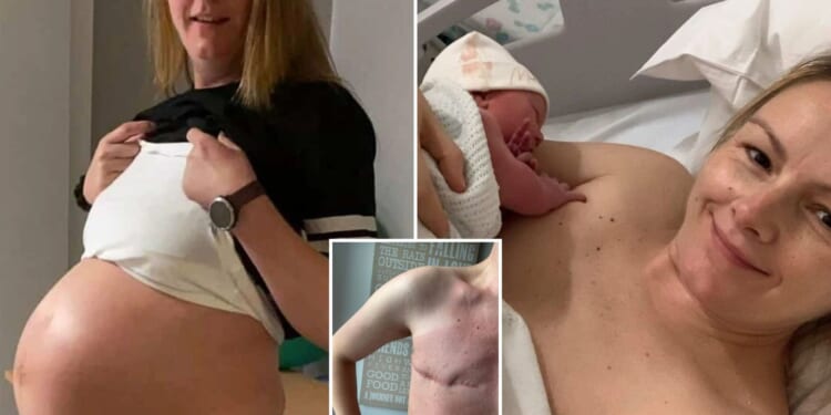 I ignored my wonky breasts but now I have incurable cancer