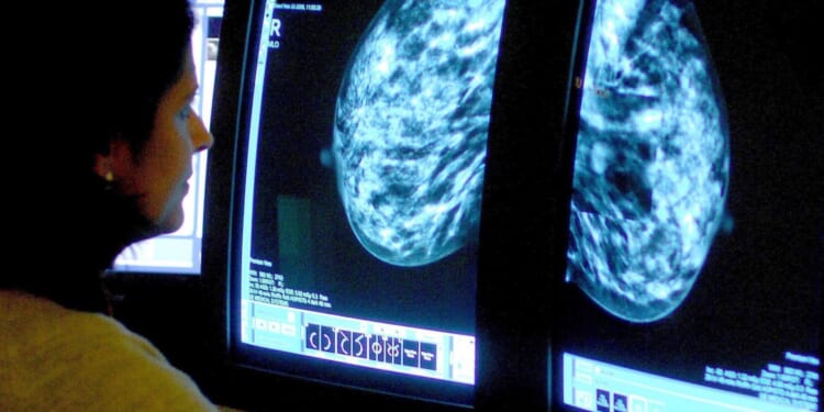 Thousands of women with breast cancer could soon be told they don’t need ANY treatment at all