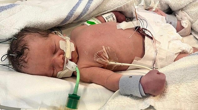 Following a month-long stay in intensive care, the infant was temporarily placed in the custody of her biological father Michael Swanson’s family