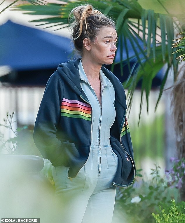 The star seen with a cut on her face in July 2025