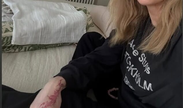 Ellie Goulding has returned to social media with a new snap days after revealing she'd given birth to her 'beautiful' second child