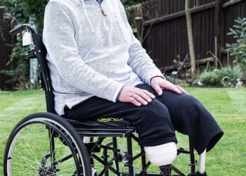 Retired stockbroker Nic Olsen, 80, recently had to have both his legs amputated due to PAD