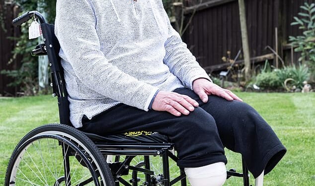 Retired stockbroker Nic Olsen, 80, recently had to have both his legs amputated due to PAD