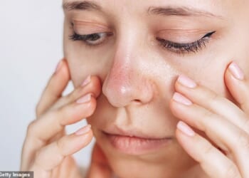 With Raynaud's, even a small degree of cooling can cause the tissue to get cold and the blood vessels to spasm. If it affects the nose, your nose will feel intensely chilly (picture posed by model)