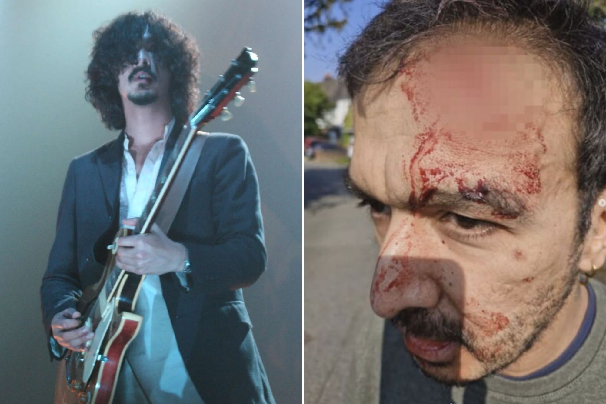 An image collage containing 2 images, Image 1 shows NINTCHDBPICT000003059139, Image 2 shows Boyan Chowdhury's face covered in blood from an injury