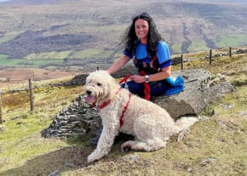 Janine Price's psoriasis came on without warning when she was pregnant with her first child