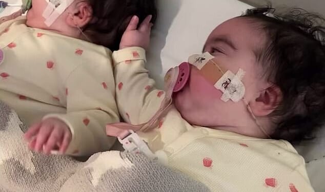 Jesy Nelson has shared new pictures of her twin daughters as they received a check-up by doctors in Great Ormond Street Hospital whilst wearing their splints