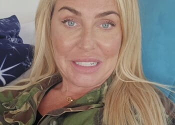 Josie Gibson has revealed she underwent liposuction and an arm lift amid her lipoedema battle