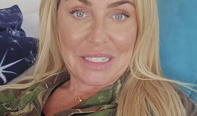 Josie Gibson has revealed she underwent liposuction and an arm lift amid her lipoedema battle