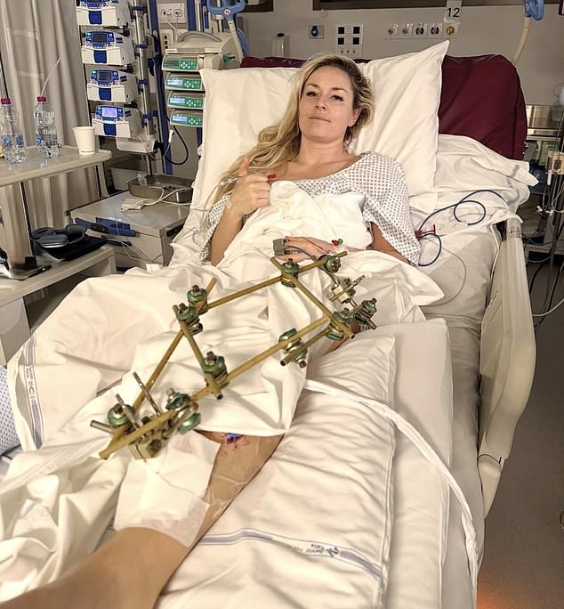 Vonn needed five surgeries in total after she came dangerously close to losing her leg