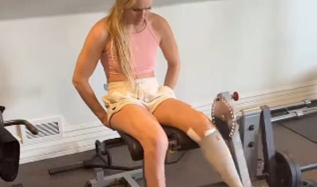 America ski hero Lindsey Vonn has been working out in the gym less than a month after nearly losing her leg