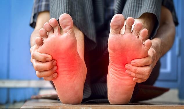 A burning sensation in the feet is likely to be caused by a nerve condition called peripheral neuropathy