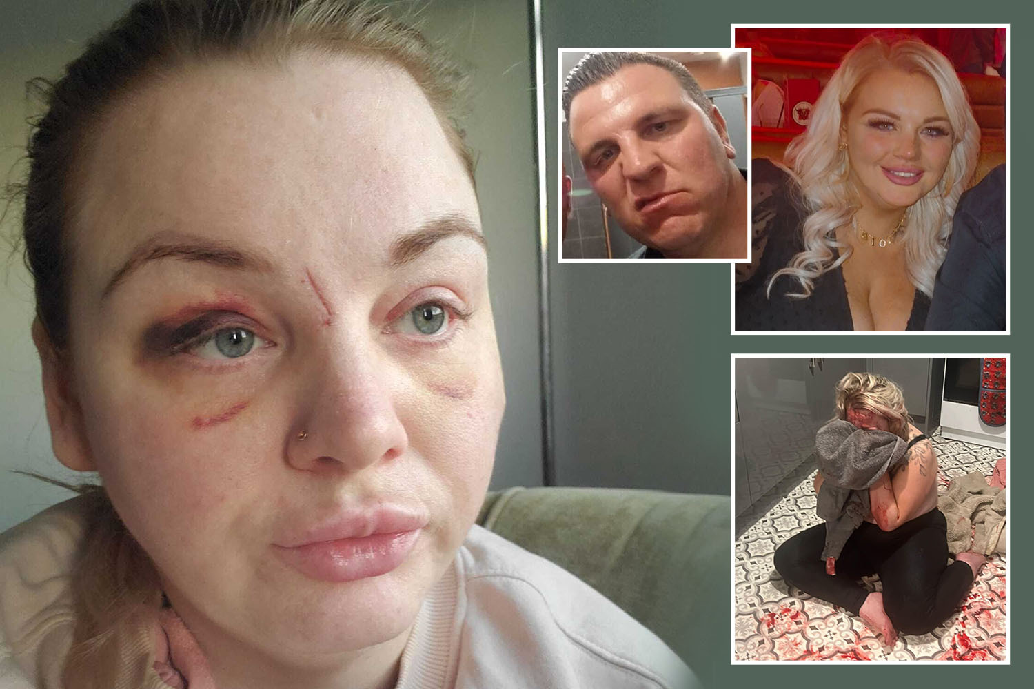 Collage of a woman with facial injuries, a man, a smiling woman, and a woman holding a baby.