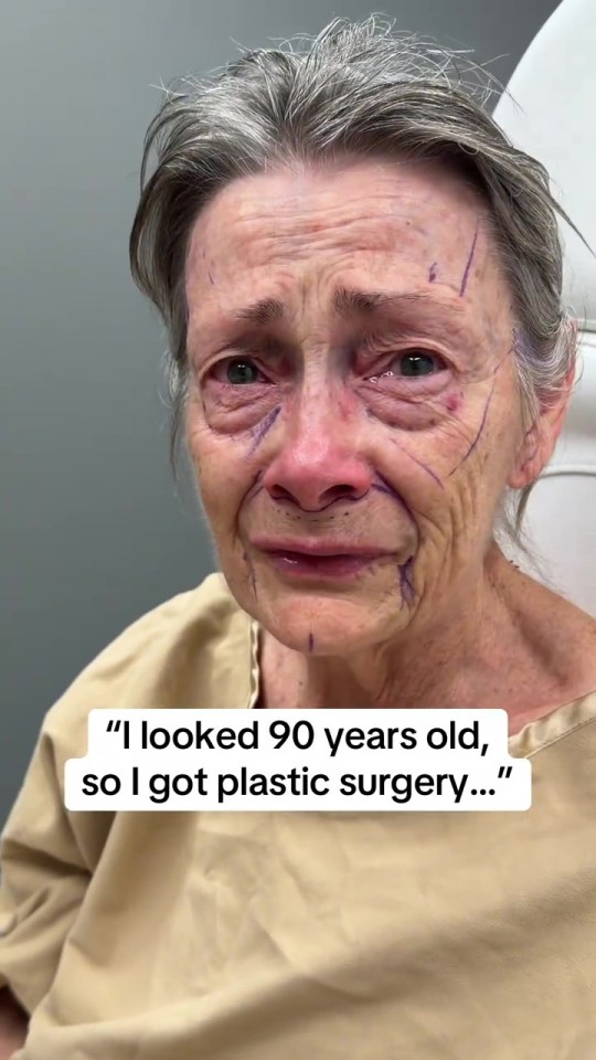 A crying woman with surgical markings on her face and the text, "I looked 90 years old, so I got plastic surgery..."