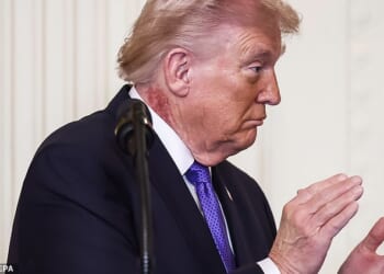 Experts speculate that Trump is suffering from actinic keratoses, an unsightly skin condition that increases the risk of skin cancer