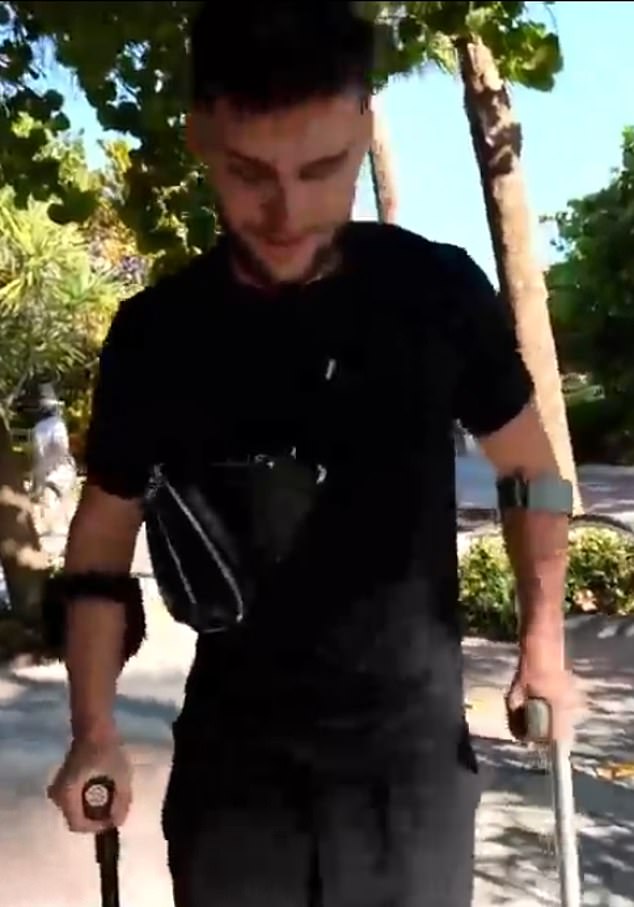 Ed was seen walking with crutches, having broken his shinbone in January after jumping off a van for a social media stunt