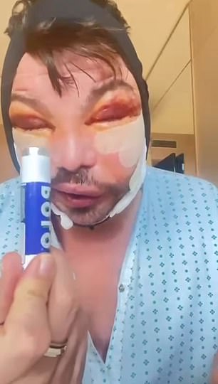 Bobby looked to be in pain in the new video