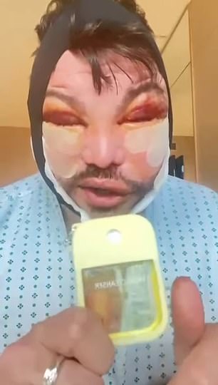 His face was visibly swollen and bruised